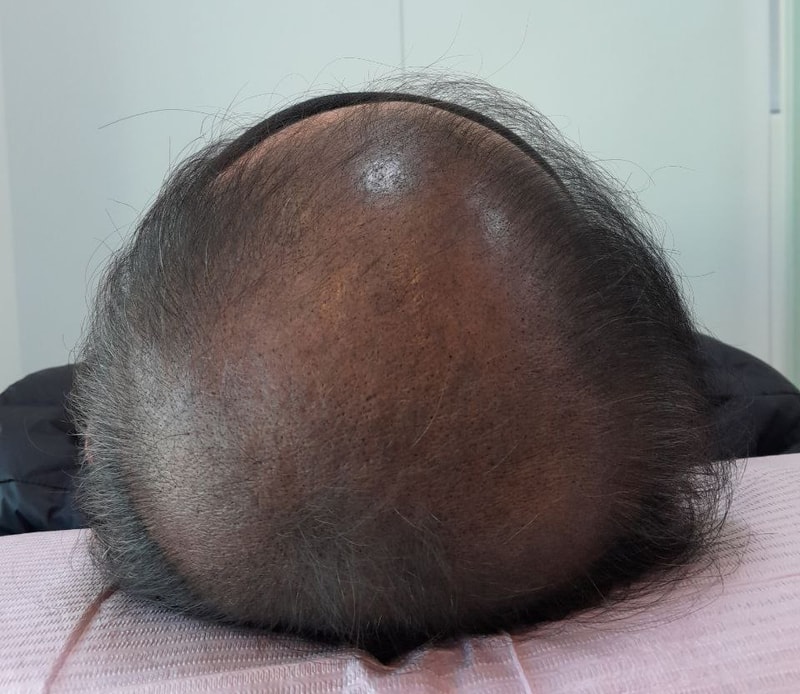 이호국 리터치후01.jpg