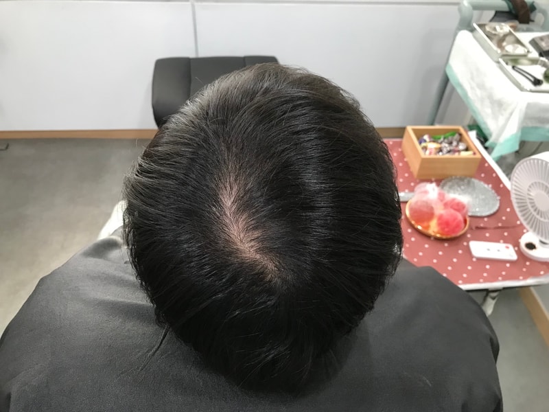 1_before.jpg