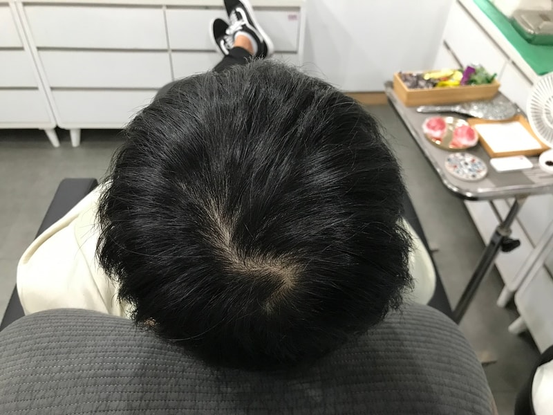 before2.jpg