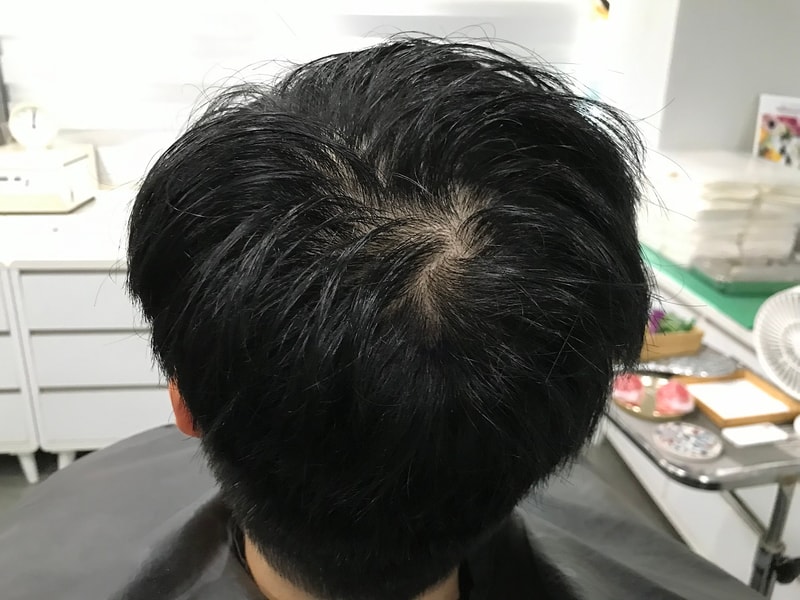 before3.jpg