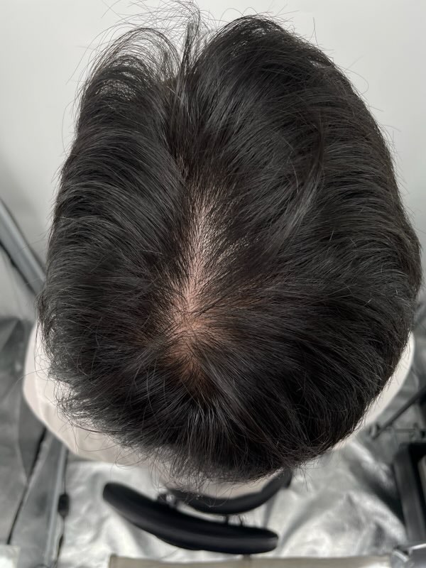 전후사진만 봐도 달라졌습니다. 완전 만족!