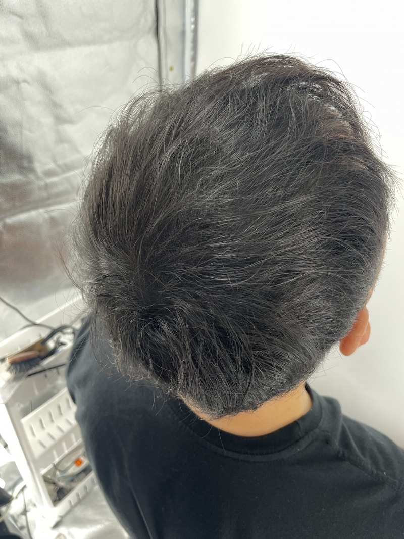 우리 남편도 뉴헤어 두피문신 받았어요 가족들 다 추천 중