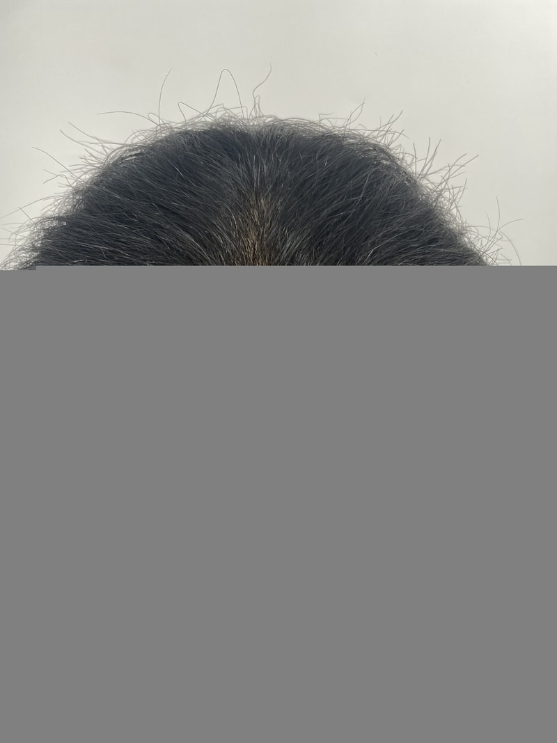 흑채 안뿌리게 된 두피문신 후기 