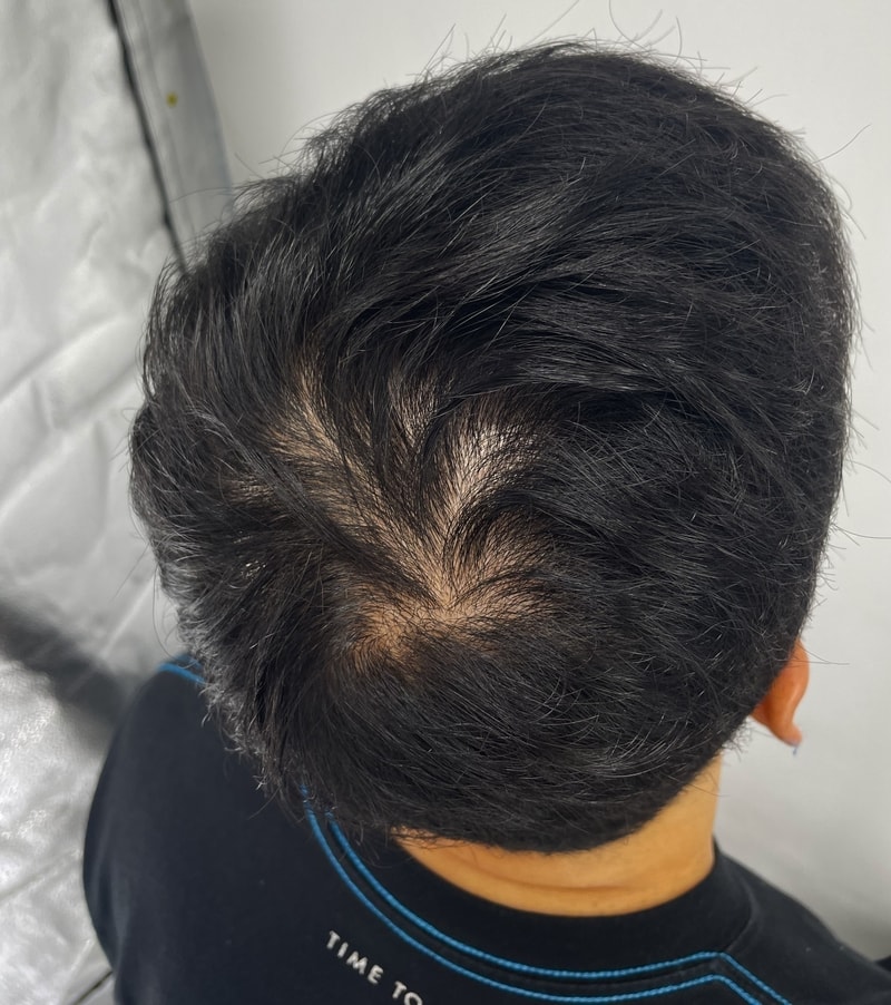 저도 뉴헤어 받고 제 동생도 뉴헤어에서 받았어요