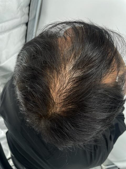 인위적일까 걱정했는데 내것 같고 자연스럽습니다