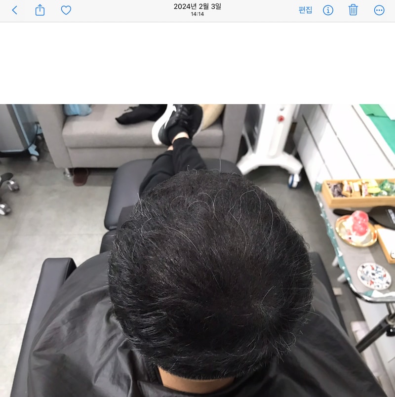 시술후 (2).jpg