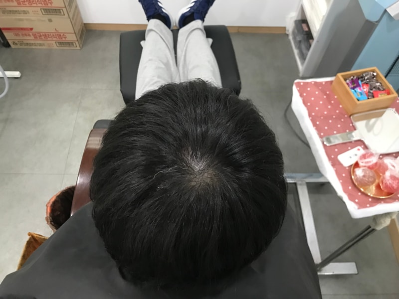 Yonsei Midain Clinic修饰后记