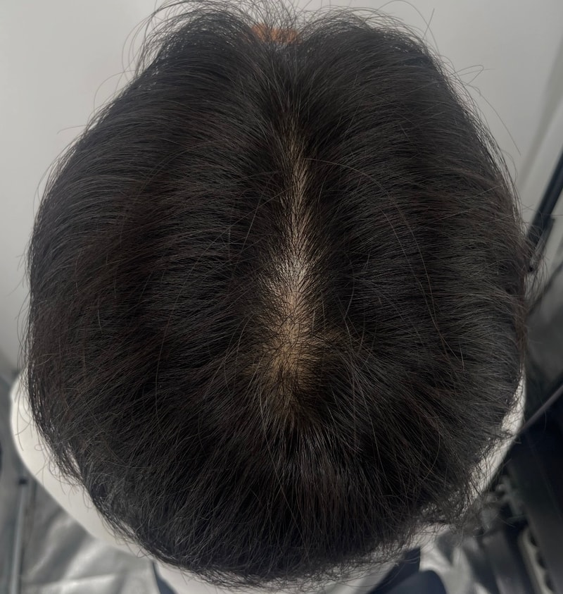 男性中分两次头皮纹身