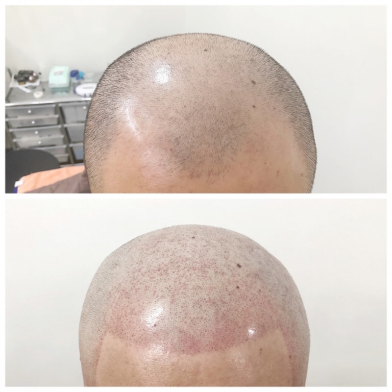KakaoTalk_20180919_181520253.jpg