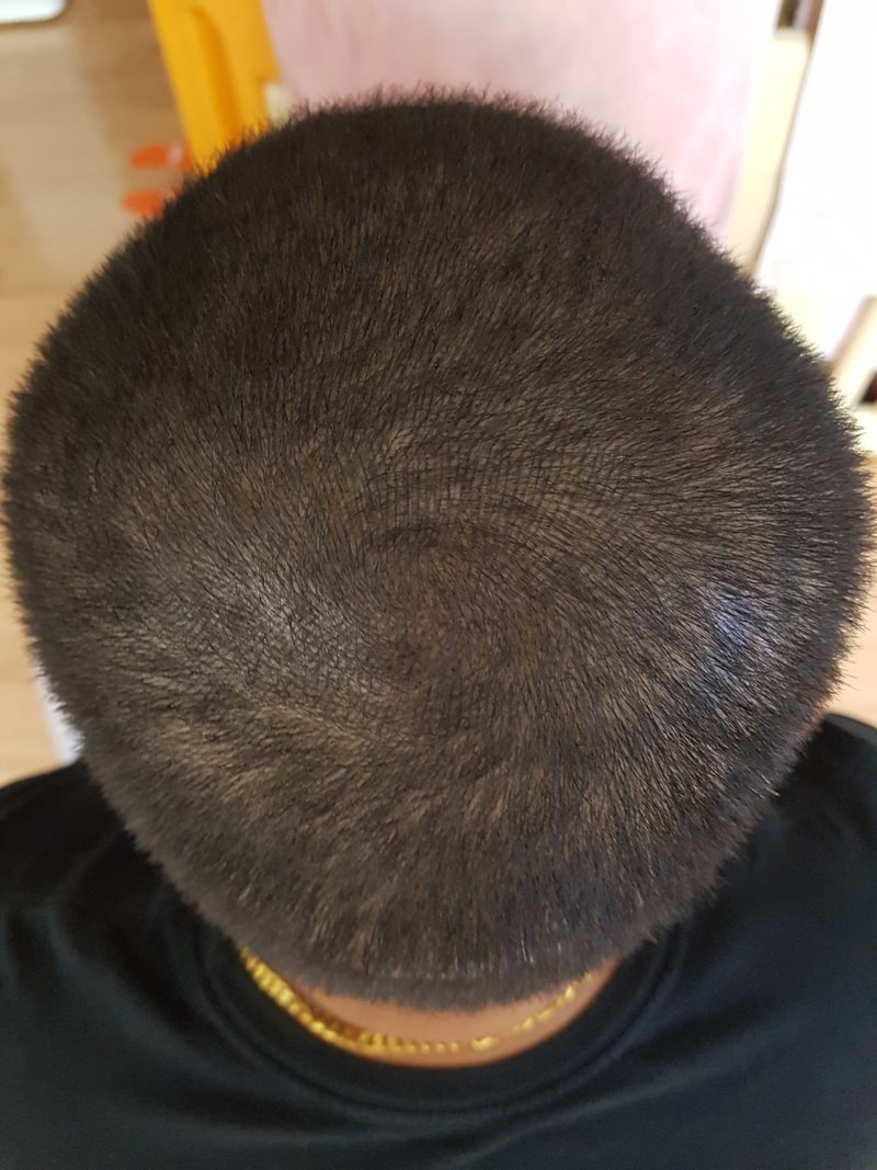 후3.jpg