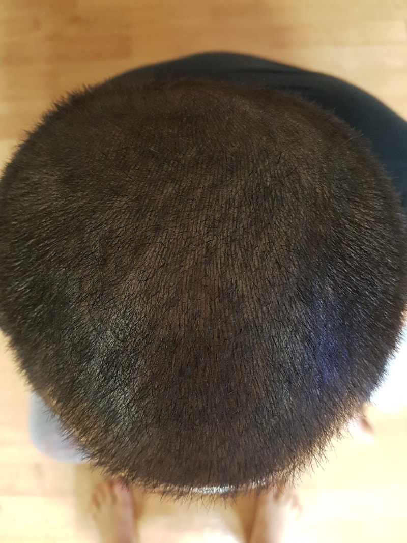 후2.jpg