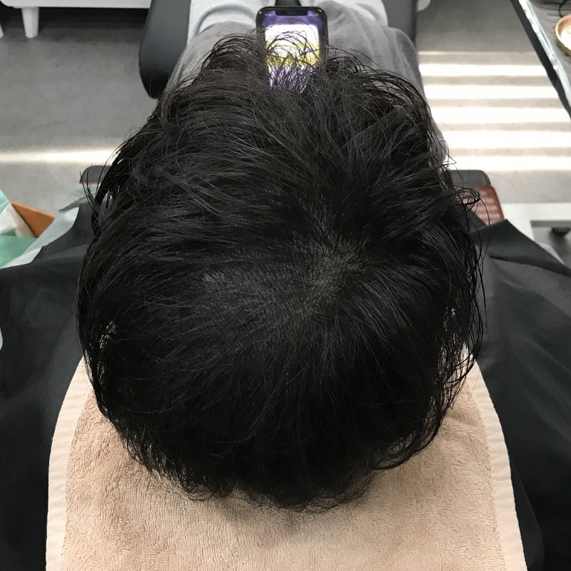 시술후 2.jpg