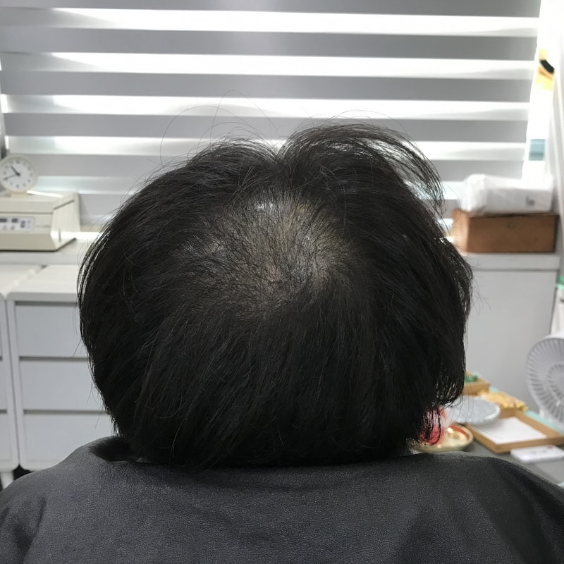 2차 시술 전 2.jpg