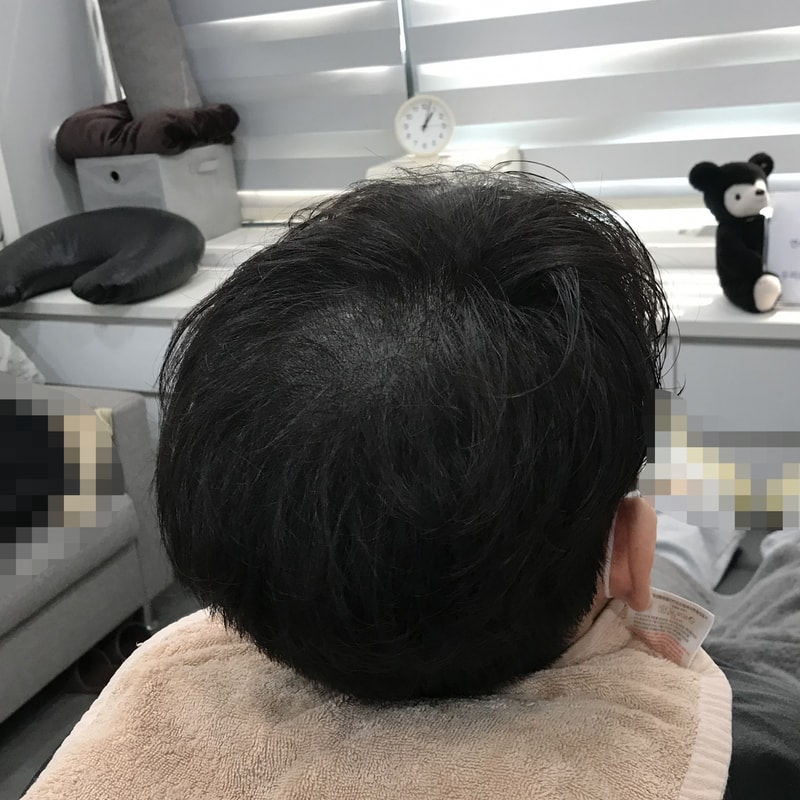 시술후 3.jpg