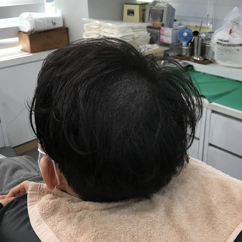 시술후 1.jpg