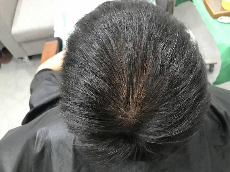 시술전 물안묻은상태.jpg