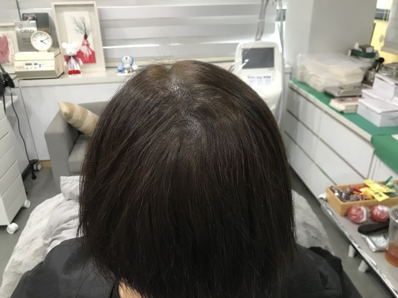 후1마른 머리 상태.jpg