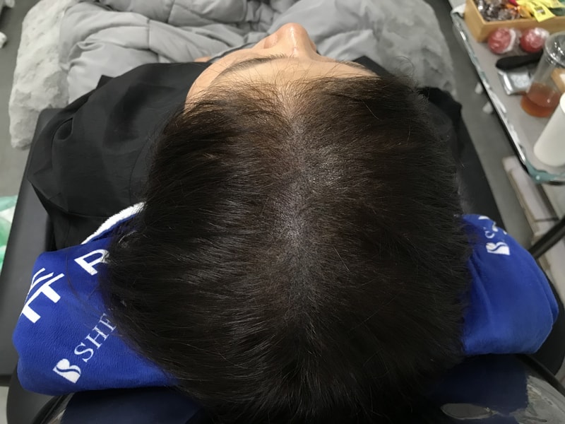 후2마른 머리 상태.jpg