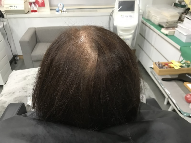 전1마른 머리 상태.jpg
