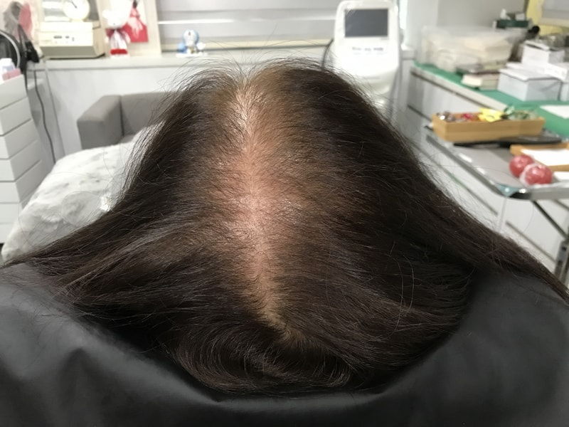 전2마른 머리 상태.jpg
