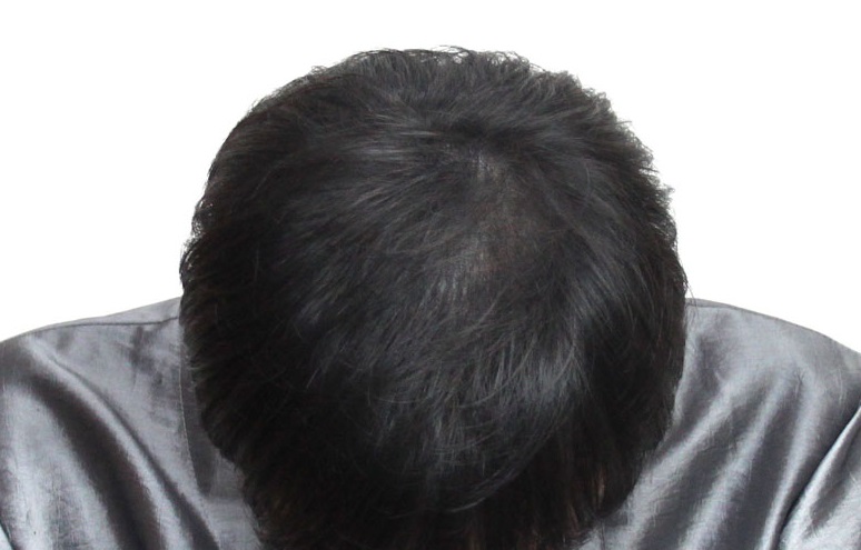 S SMP 직후1.JPG
