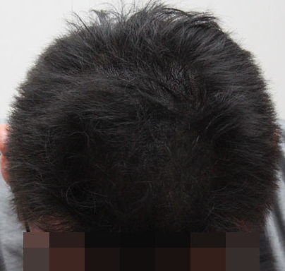 후2.jpg