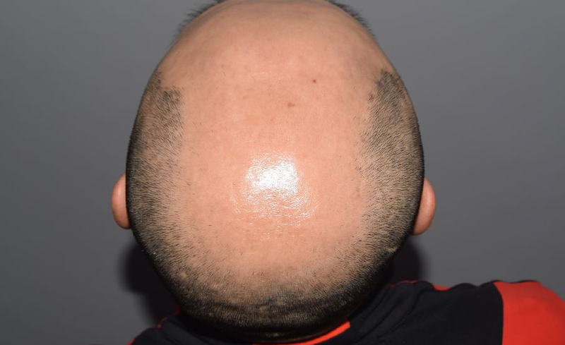 2_1.png