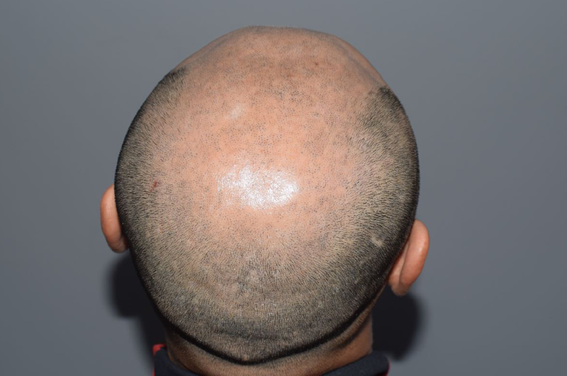 2_2.png