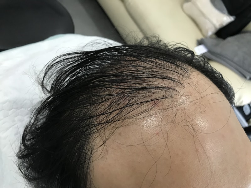 시술전1.jpg