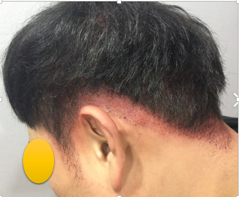 후 3.png