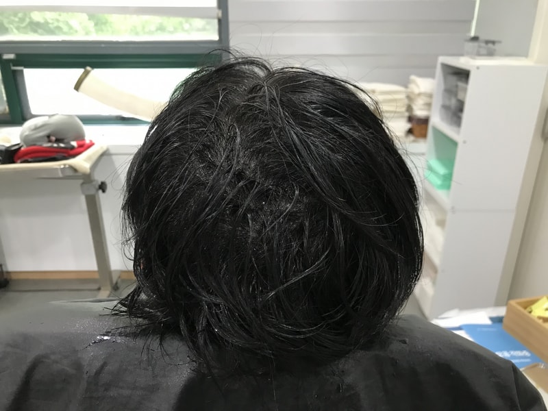 두피문신 리터치 받고왔습니다