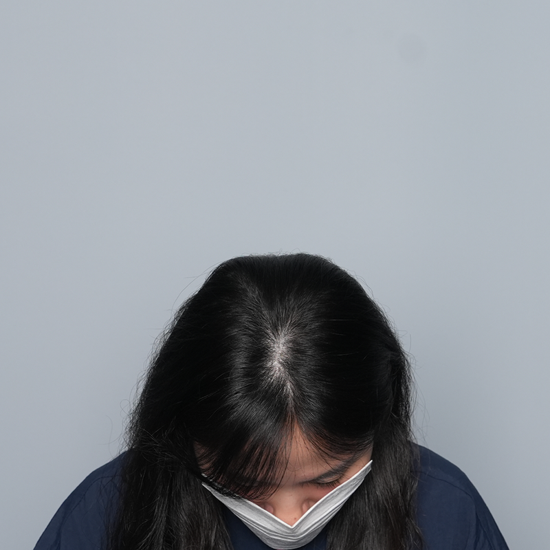 [GRACITY] 发缝 头皮纹身 2次为止