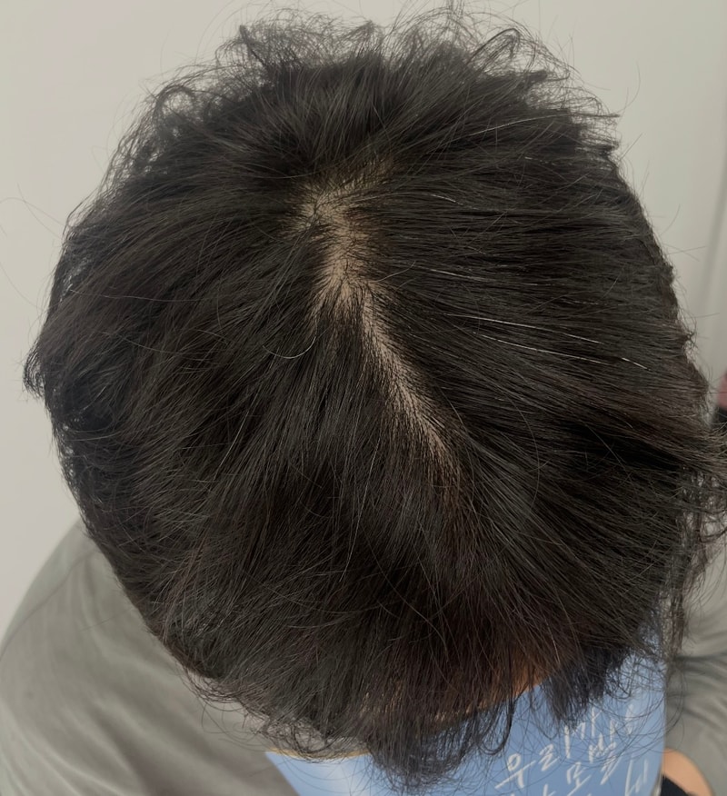 남성 가르마 두피문신 제일 잘하는 뉴헤어!!
