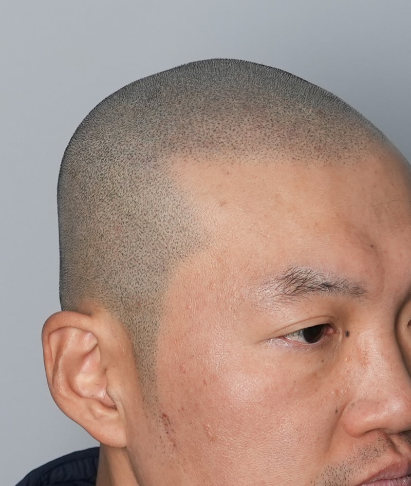 삭발 두피문신 그레이시티