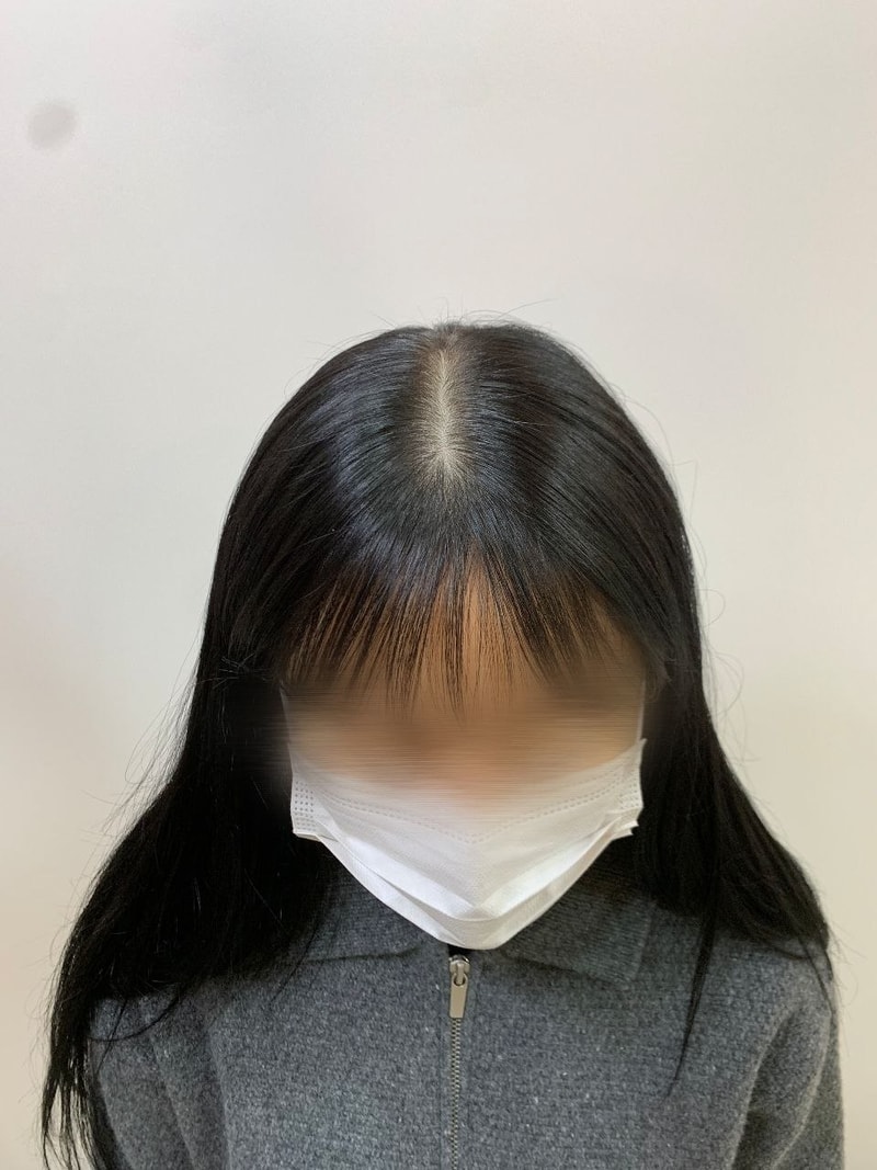 시술 전.jpg