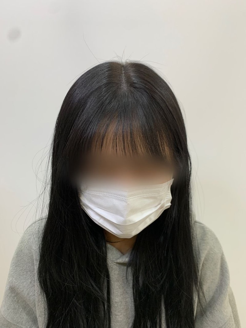 시술 후.jpg