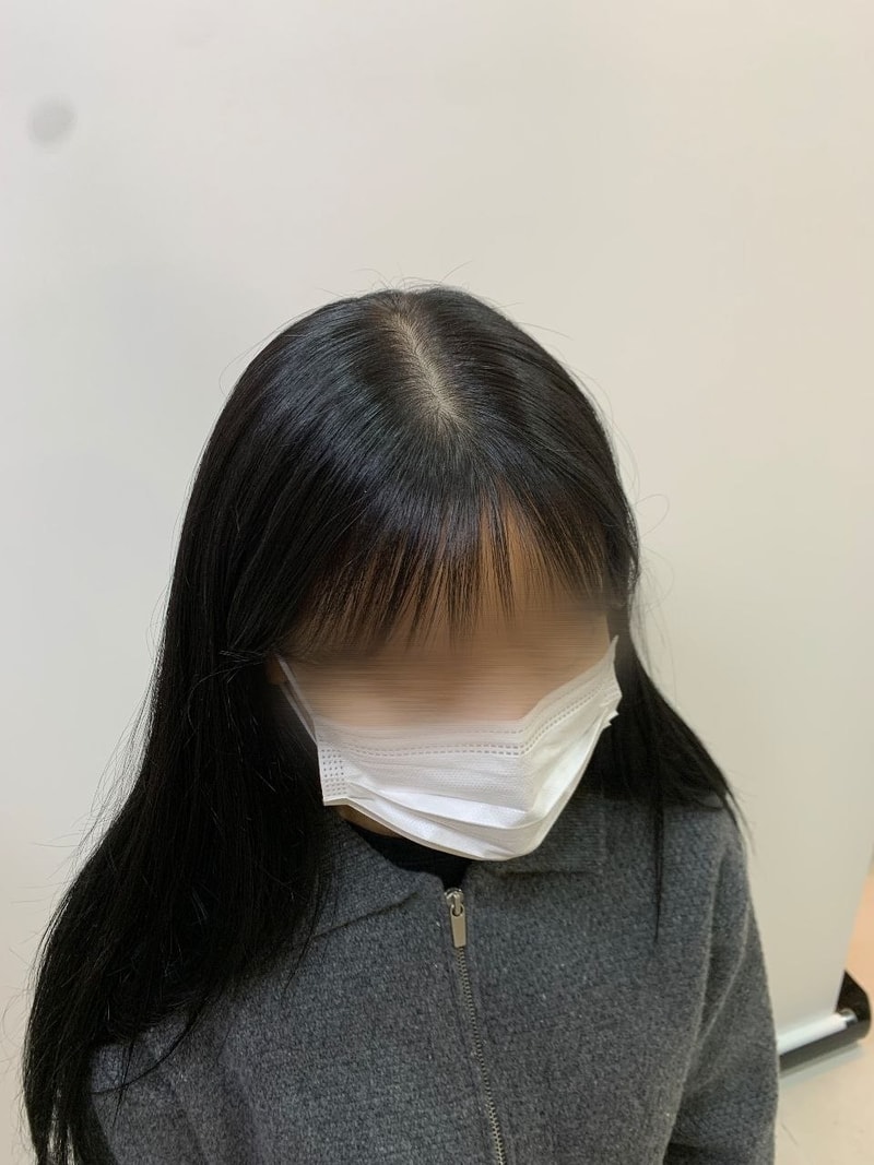 시술 전2.jpg
