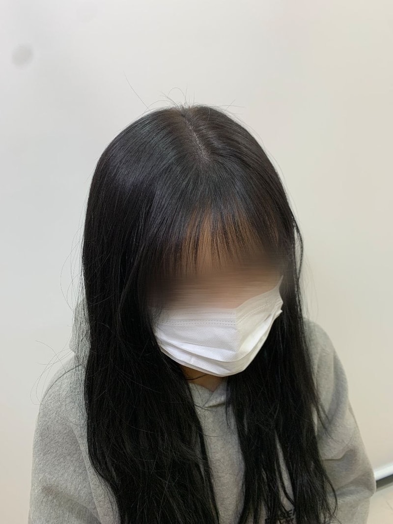 시술 후2.jpg