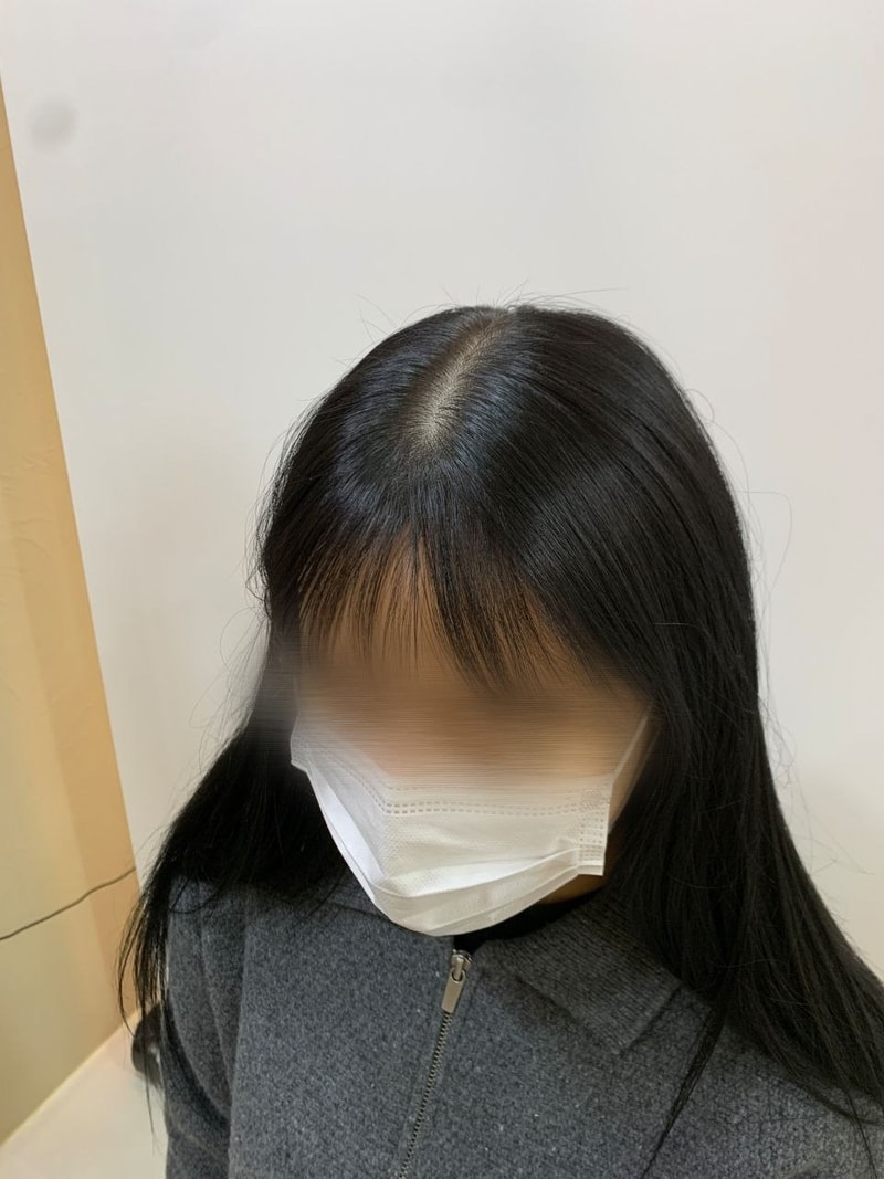 시술 전3.jpg
