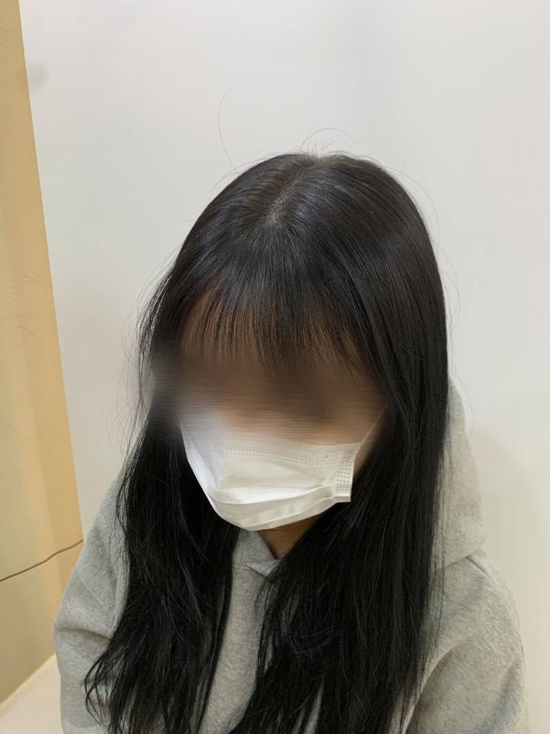 시술 후3.jpg