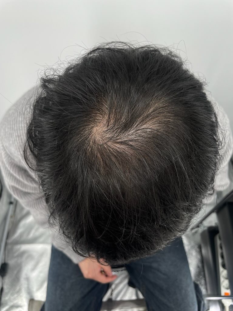 네이버에 강남 두피문신 검색하다가 후기 좋은 곳 위주로 살펴보고 방문하게 되었어요.