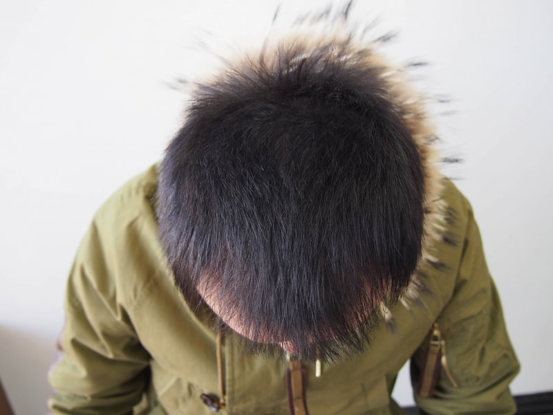 포맷변환_시술후.jpg