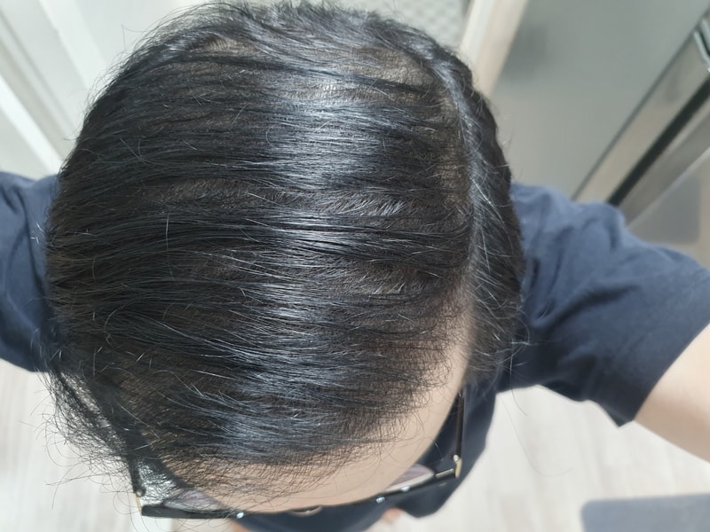 KakaoTalk_20250301_222544583_01.jpg