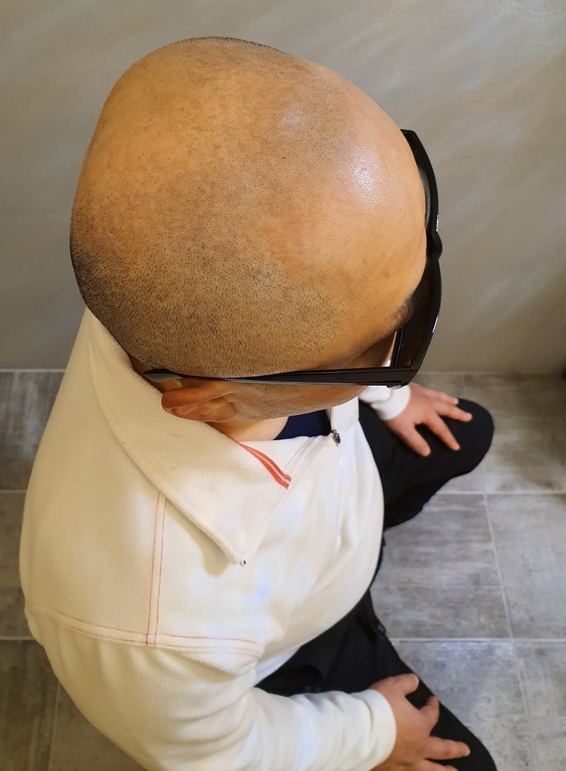 전.jpg