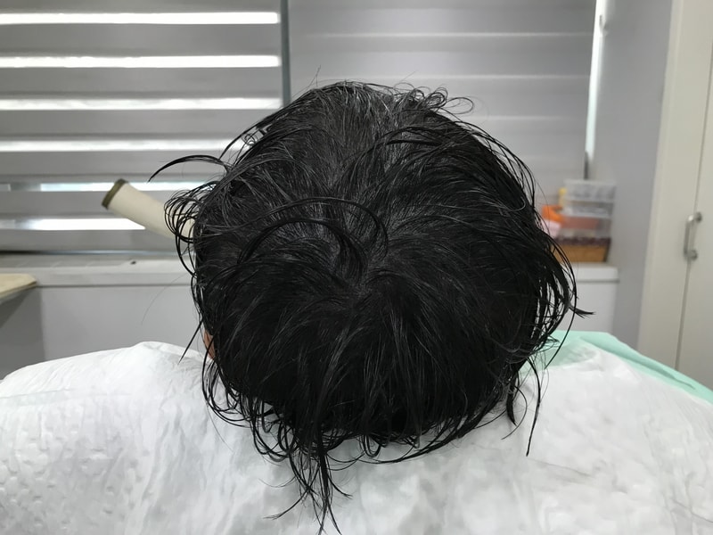 리 후 1.jpg
