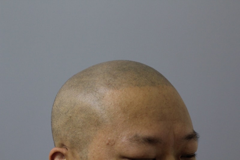 시술후_IMG_2.JPG