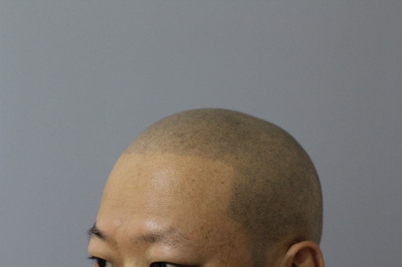 시술후_IMG_3.JPG