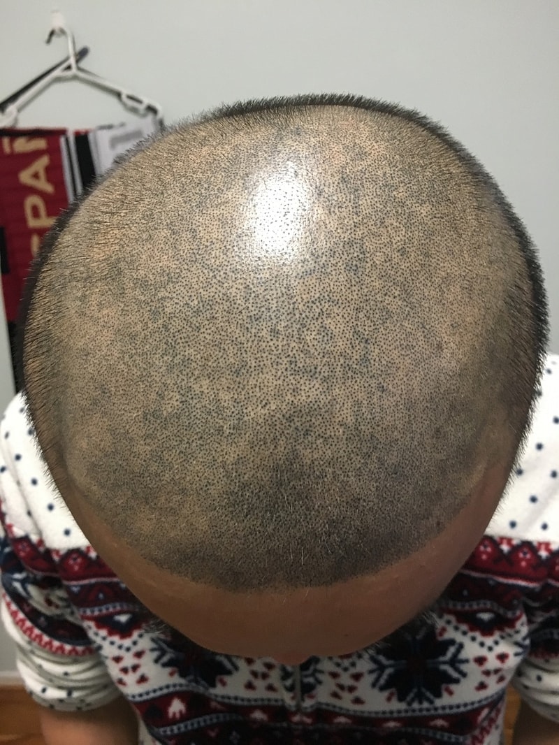 리터치1.jpg