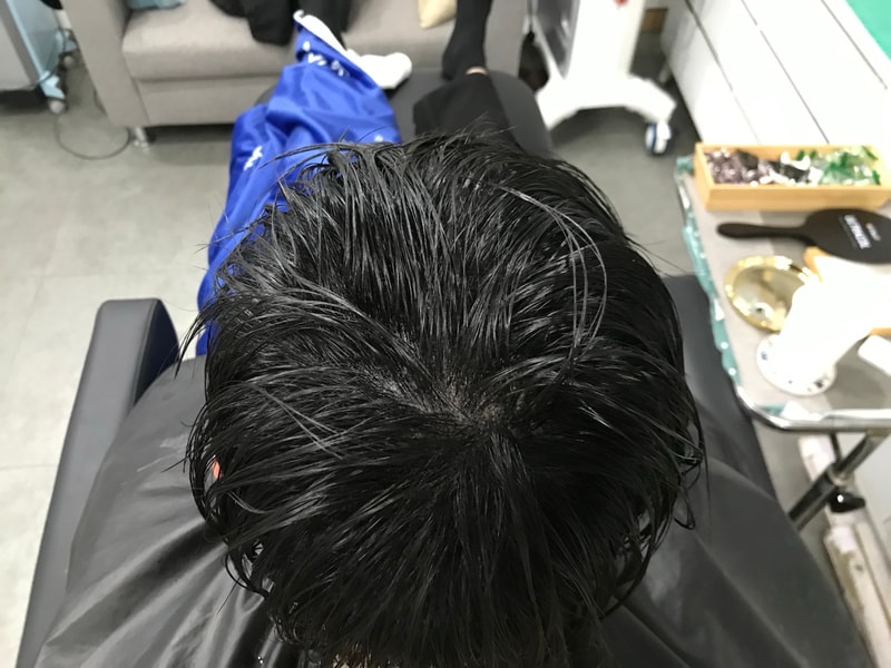 시술 후.jpg
