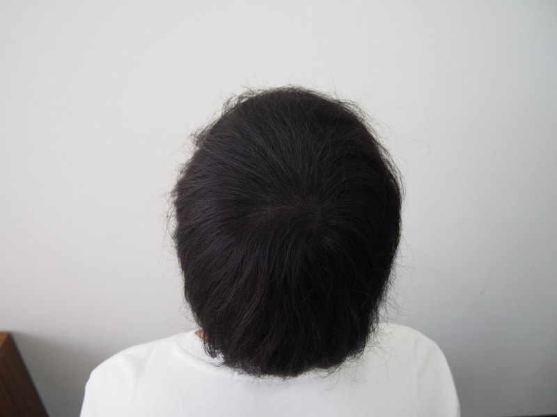 후.JPG
